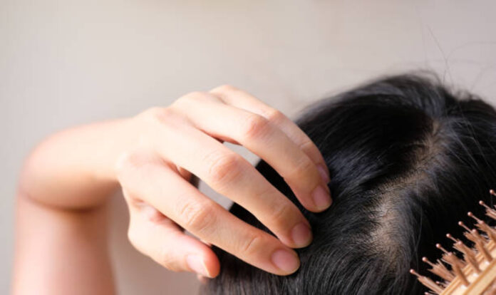 Hands touching scalp